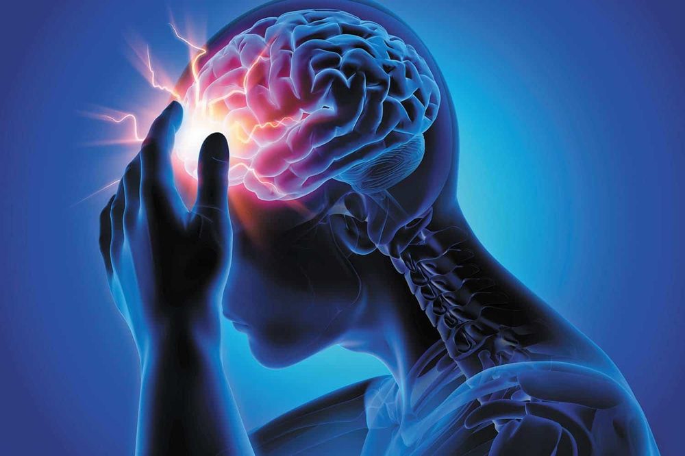 Migraines